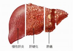 廣州送菜公司了解富川富陽鎮千畝蔬菜種植基地助農增收